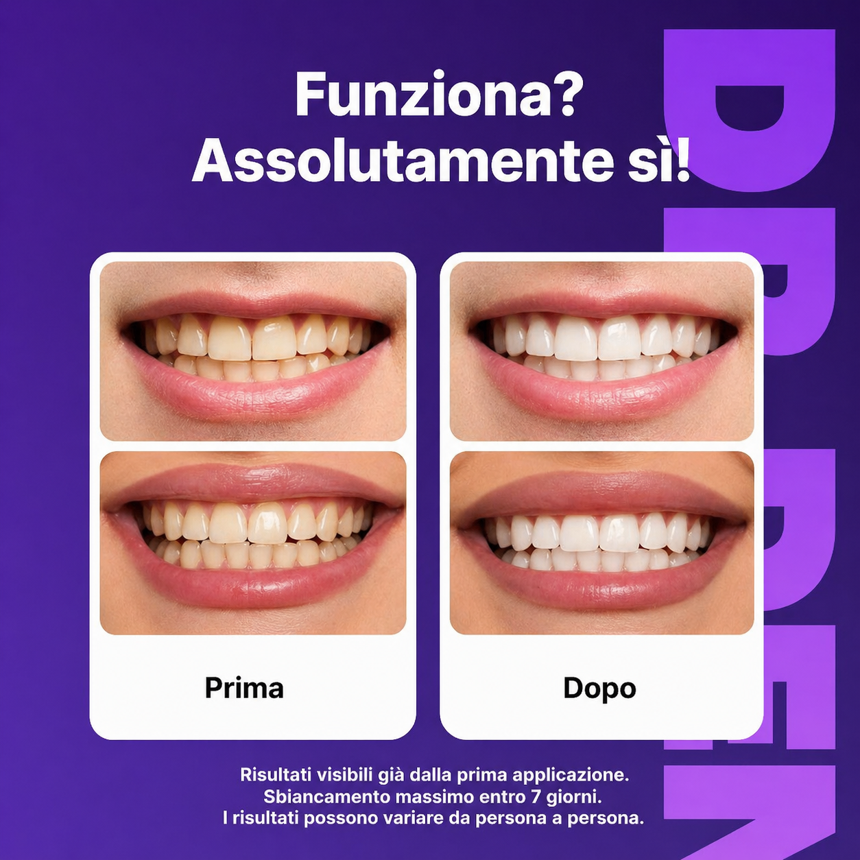 Aviwa™ Strisce Sbiancanti Dentali